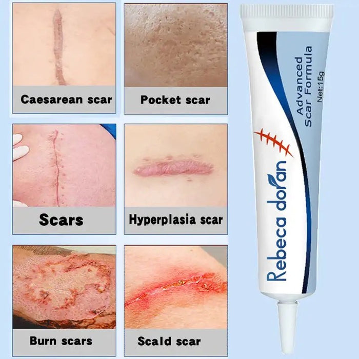 Scar Removal cream