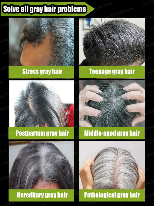 Gray Hair Treatment Serum | White to Black Natural Color Repair Nourishing Products | Anti-Hair Loss Care | Men | Women