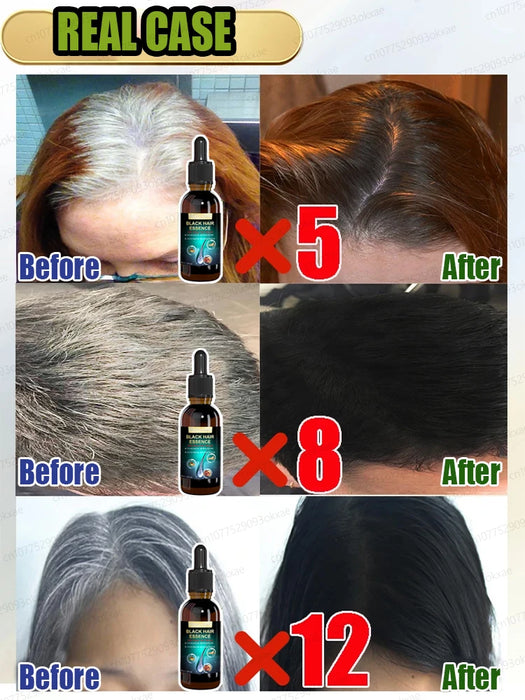 Gray Hair Treatment Serum | White to Black Natural Color Repair Nourishing Products | Anti-Hair Loss Care | Men | Women