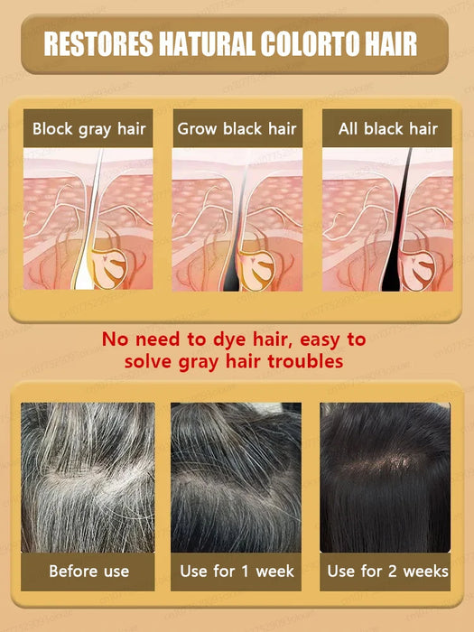 Gray Hair Treatment Serum | White to Black Natural Color Repair Nourishing Products | Anti-Hair Loss Care | Men | Women