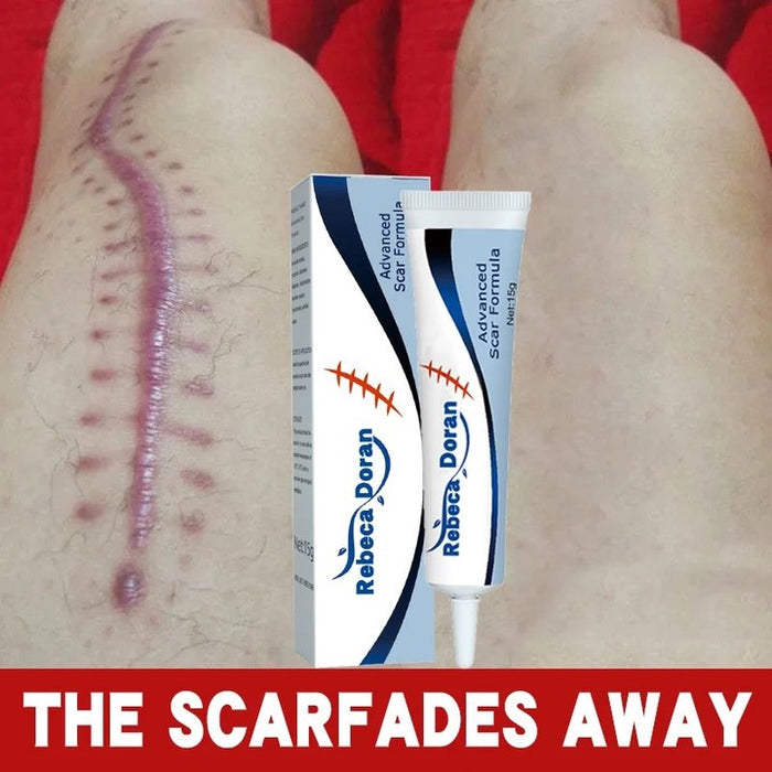 Scar Removal cream