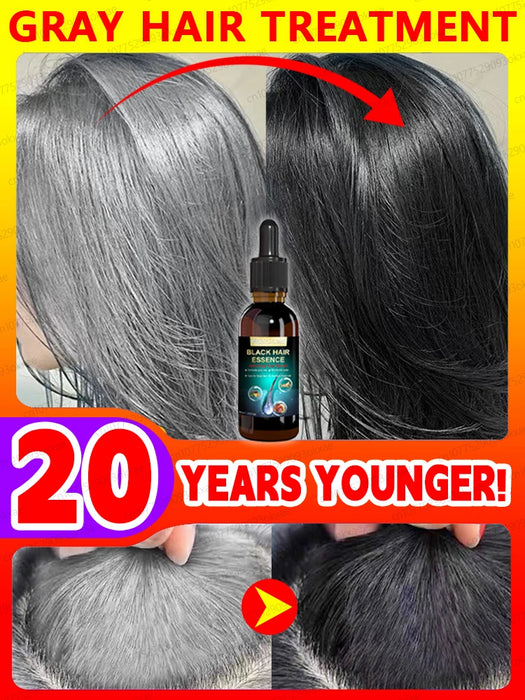 Gray Hair Treatment Serum | White to Black Natural Color Repair Nourishing Products | Anti-Hair Loss Care | Men | Women